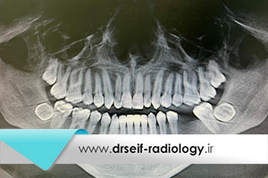 رادیولوژی تخصصی فک، دهان و صورت در تهران