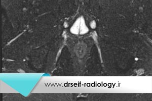 در چه مواقعی باید رادیولوژی فیستولوگرافی انجام شود؟