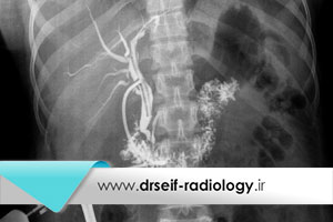 رادیولوژی کلانژیوگرافی چیست؟