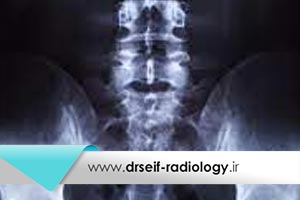 خطرات و عوارض رادیولوژی و رادیوگرافی چیست؟