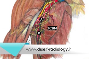 لنف نود در اگزیلا چیست؟