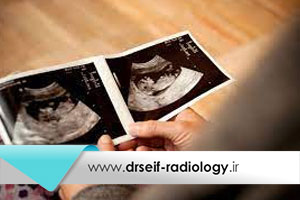 تفاوت جنین دختر و پسر در سونوگرافی
