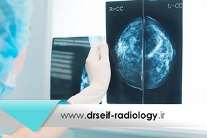 ماموگرافی بهتر است یا سونوگرافی پستان؟