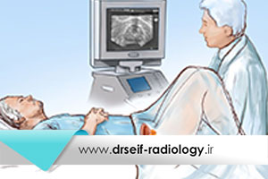 سونوگرافی ترانس رکتال (TRUS) برای تشخیص سرطان پروستات