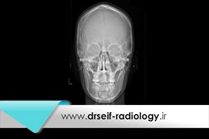 مزايای سفالومتری ديجيتالی در مقابل سفالومتری فيلمی