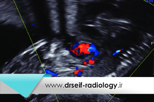 کاربرد سونوگرافی رنگی چیست؟