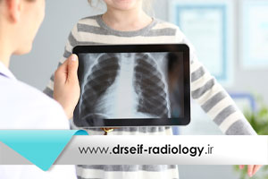 تشخیص بیماریهای کودکان با رادیولوژی و رادیوگرافی