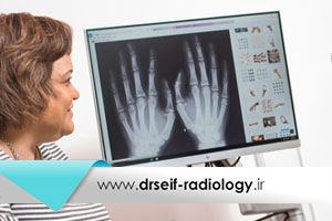 روشهای تصویر برداری جهت تشخیص آرتریت روماتوئید