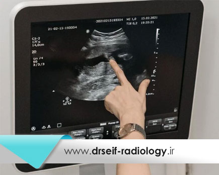 اهمیت سونوگرافی | سونوگرافی برای چیست و چه آمادگی نیاز دارد؟