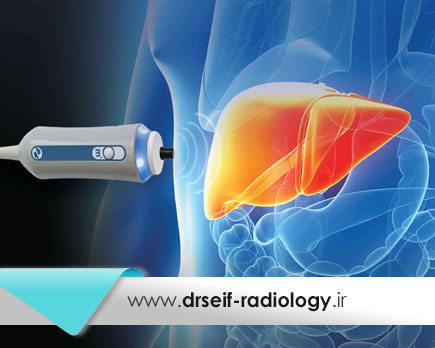 همه چیز در مورد فیبرو اسکن | کاربرد، مزایا و نحوه انجام فیبرواسکن