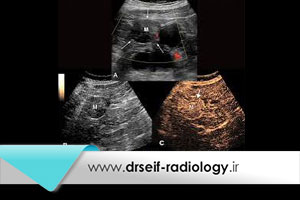 تفاوت سونوگرافی داپلر و معمولی چیست؟