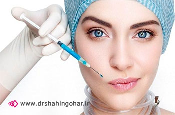 فیلر چیست و انواع فیلرها کدامند؟