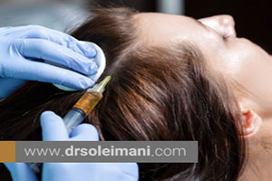 کربوکسی تراپی مو روش موثر درمان ریزش