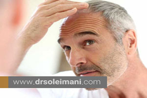 بهترین داروهای درمان ریزش موی سر چیست؟