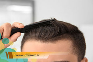 لیزر تراپی مو برای درمان ریزش موها