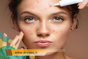 درمان جوش صورت با محلول آنتی بیوتیک
