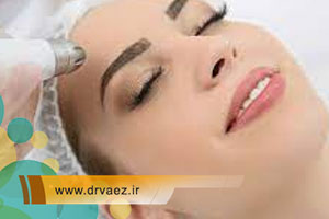 لیزر درمانی مؤثر برای رفع لک های صورت