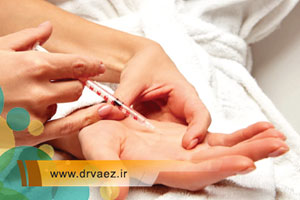 تزریق بوتاکس تعریق توسط پزشک متخصص | هزینه بوتاکس تعریق در اصفهان