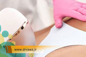 لیزر موهای زائد بیکینی | هزینه لیزر موهای زائد واژن در اصفهان