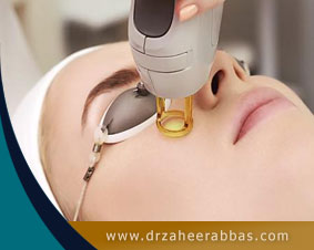 Fractional laser