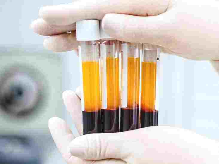 Platelet Rich Plasma