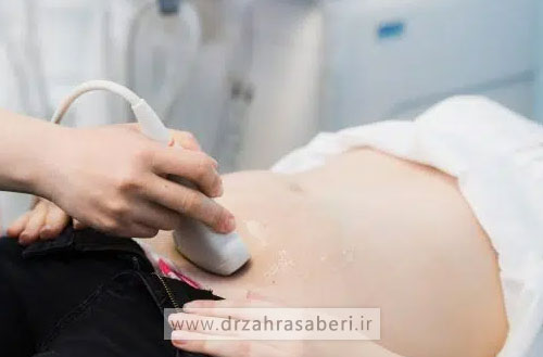 کیست تخمدان؛ علائم و روش های تشخیص آن