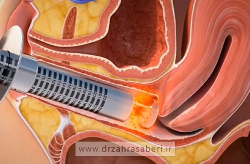 مرکز تخصصی لیزر مونالیزا در اصفهان؛ تکنولوژی پیشرفته در کلینیک دکتر صابری