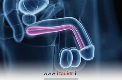 شکستگی آلت تناسلی مردان