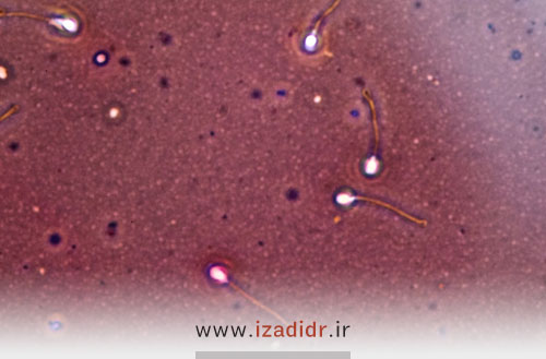 آیا شیمی درمانی و سرطان باعث ناباروری مردان میشود