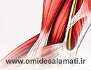 نوار عصب و عضله چیست و چه کاربردی دارد؟