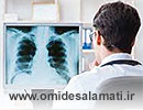 اشعه ایکس برای تشخیص بیماری قلبی