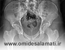 رادیولوژی لگن در منزل با دستگاه های پرتابل و تیم متخصص