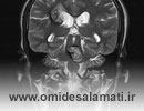 رادیولوژی مغز در منزل؛ تصویربرداری از سر و جمجمه در خانه