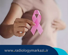 عوامل دخیل در ابتلا به سرطان پستان