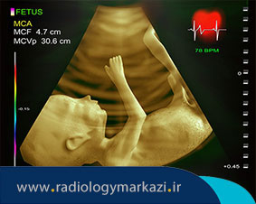 اکو قلب جنین (اکوکاردیوگرافی جنین) در چه مواردی انجام میشود؟