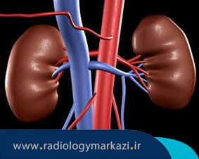 عکس رنگی کلیه (IVP) چیست و چگونه انجام می شود؟