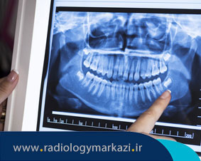 موارد قابل تشخیص توسط OPG دندان