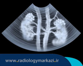 برای بررسی کلیه انجام سونوگرافی لازم است یا رادیولوژی؟