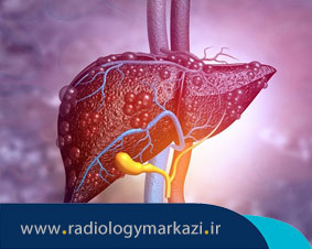 تشخیص بیماریهای مزمن کبد با تکنیک جدید سونوگرافی