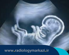 سونوگرافی های ضروری در دوران بارداری