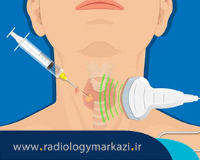 آیا بیوپسی خطرناک است؟