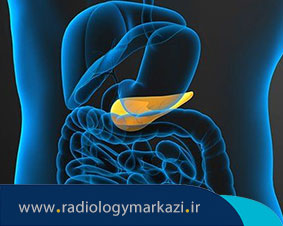 علت دیده نشدن کیسه صفرا در سونوگرافی