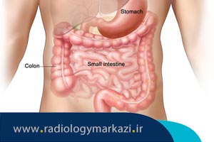 انواع تومورهای دستگاه گوارش