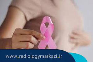 نداشتن زایمان (نولی پاریته) چه ارتباطی با سرطان پستان دارد؟
