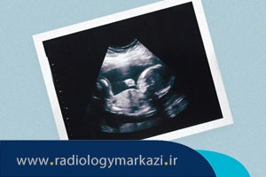 انواع سونوگرافی های بارداری در جدول