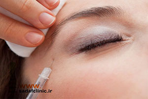 درمان چین و چروک اطراف چشم