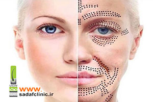 پلاسماجت چیست و چه کاربردی دارد؟