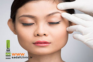 جراحی لیفت ابرو چیست؟