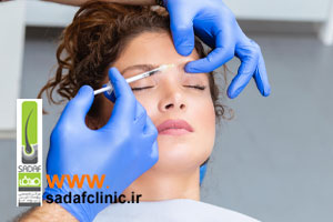 تزریق ژل خط اخم، بهترین راه برای از بین بردن خط اخم عمیق