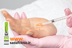 بوتاکس ضد تعریق در کلینیک صدف اصفهان برای تعریق بیش ار حد